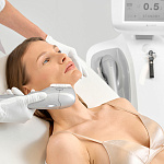 SMAS-лифтинг ULTRAFORMER III