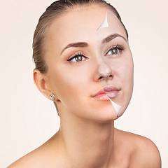 Поверхностный химический пилинг