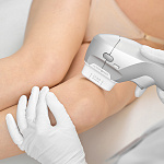 SMAS-лифтинг ULTRAFORMER