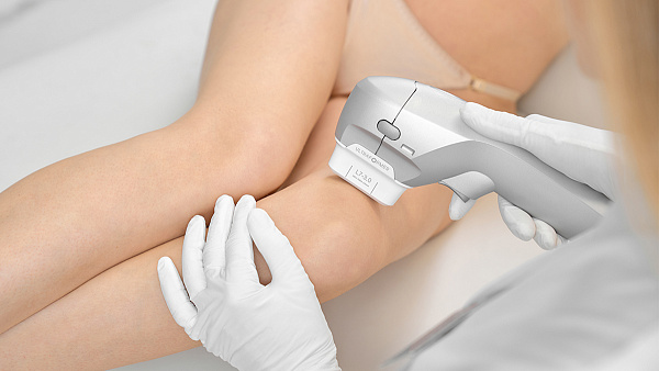 SMAS-лифтинг ULTRAFORMER