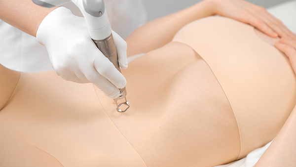 Фракционное омоложение Fotona