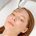 Лазерный пилинг