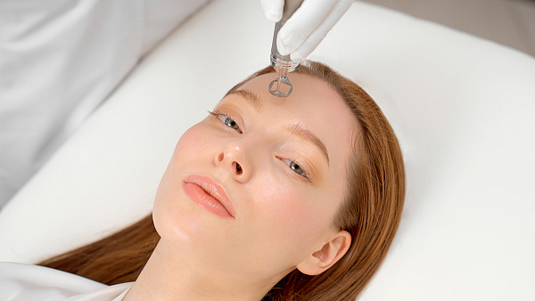 Лазерный пилинг