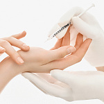 Лечение гипергидроза