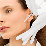 Лифтинг мезонитями