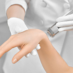 Лазерная эпиляция TRIPLE | TRIPLE X