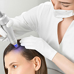 Scarlet микроигольчатый RF-лифтинг