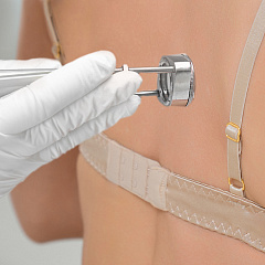 Лазерная эпиляция спины для мужчин и женщин