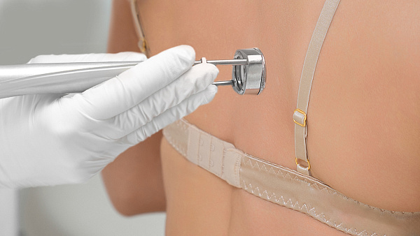 Лазерная эпиляция спины для мужчин и женщин