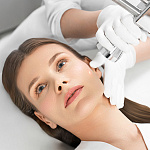 BBL шлифовка лица