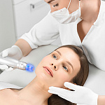 Scarlet микроигольчатый RF-лифтинг