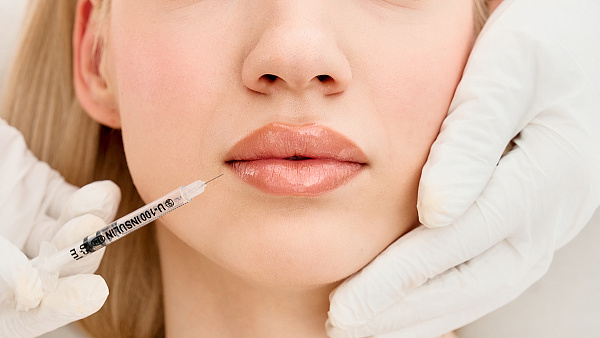 Контурная пластика губ