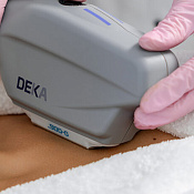 Термолифтинг Luxea