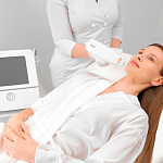 Venus Viva радиочастотная абляция