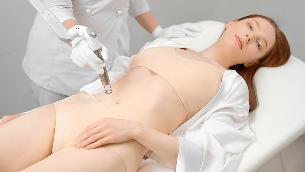 Fotona лазерная полировка кожи