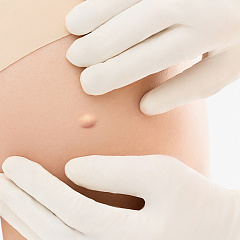 Лечение атеромы: удаление атеромы (жировика) на теле лазером