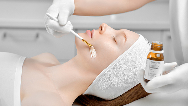 Химический пилинг