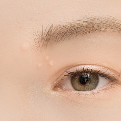 Лечение контагиозного моллюска