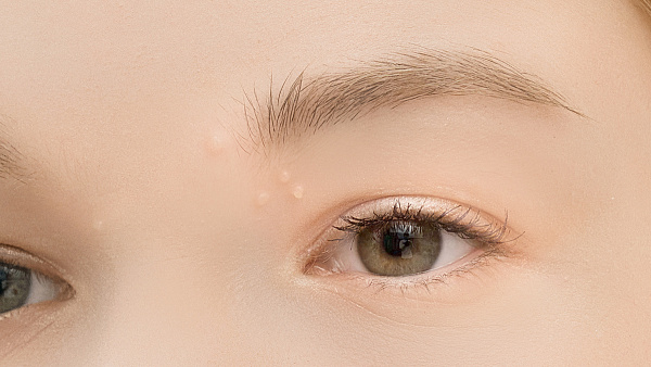 Лечение контагиозного моллюска