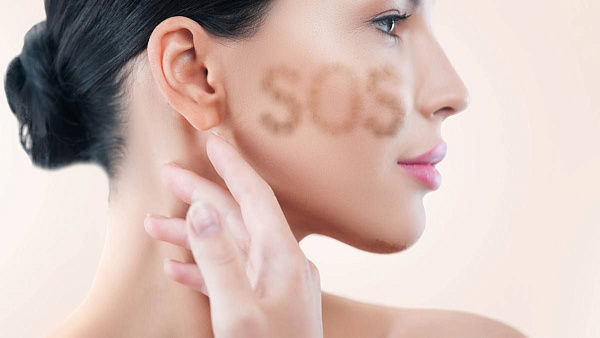 Удаление пигментных пятен лазером Fraxel