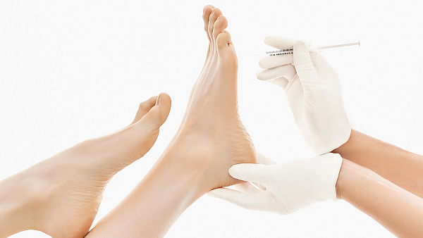 Лечение гипергидроза стоп