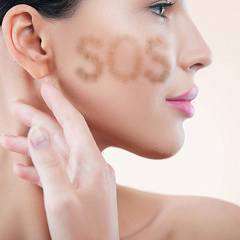 Лечение пигментации Laser Toning