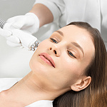 Venus Freeze для лица