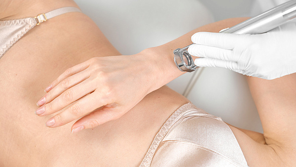 Лазерная эпиляция рук