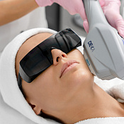 Термолифтинг Luxea