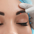 Перманентный макияж — не навсегда: как удалить татуаж без последствий