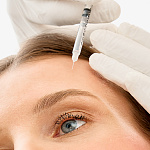 Удаление мимических морщин