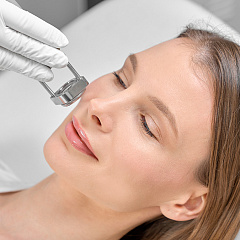 Лазерная эпиляция верхней губы