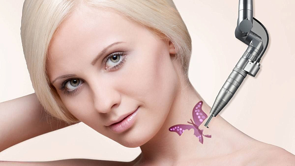 Удаление цветных татуировок на лазере SPECTRA