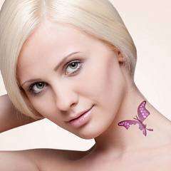 Удаление татуировок на лазере "Ланцет"