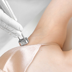 Лазерная эпиляция подмышек