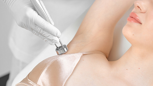 Лазерная эпиляция подмышек