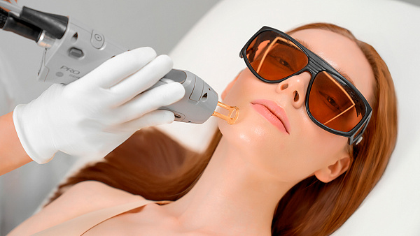 Лазерная эпиляция Candela